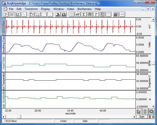 BioHarness with AcqKnowledge